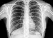KPK: Ada Campur Tangan Pimpinan DPR dalam Lelang X-Ray Kementan