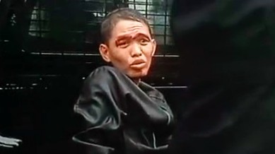 Tersangka kasus pembunuhan anak di Cilegon terlihat dengan kondisi wajah memar saat berada dalam pengamanan aparat, terkait proses hukum praperadilan yang tengah berjalan.